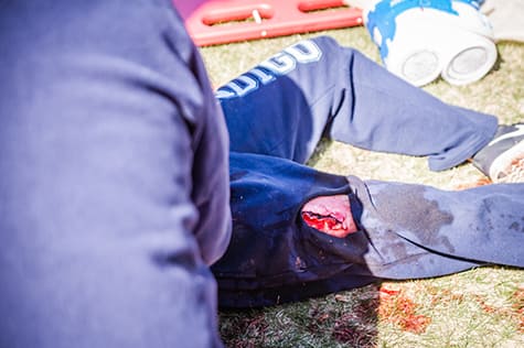 General Workplace CPR, FA, Fire Safety Category-CPR-AED-First Aid-Bloodborne Pathogens course-2 Person injured with cut on leg