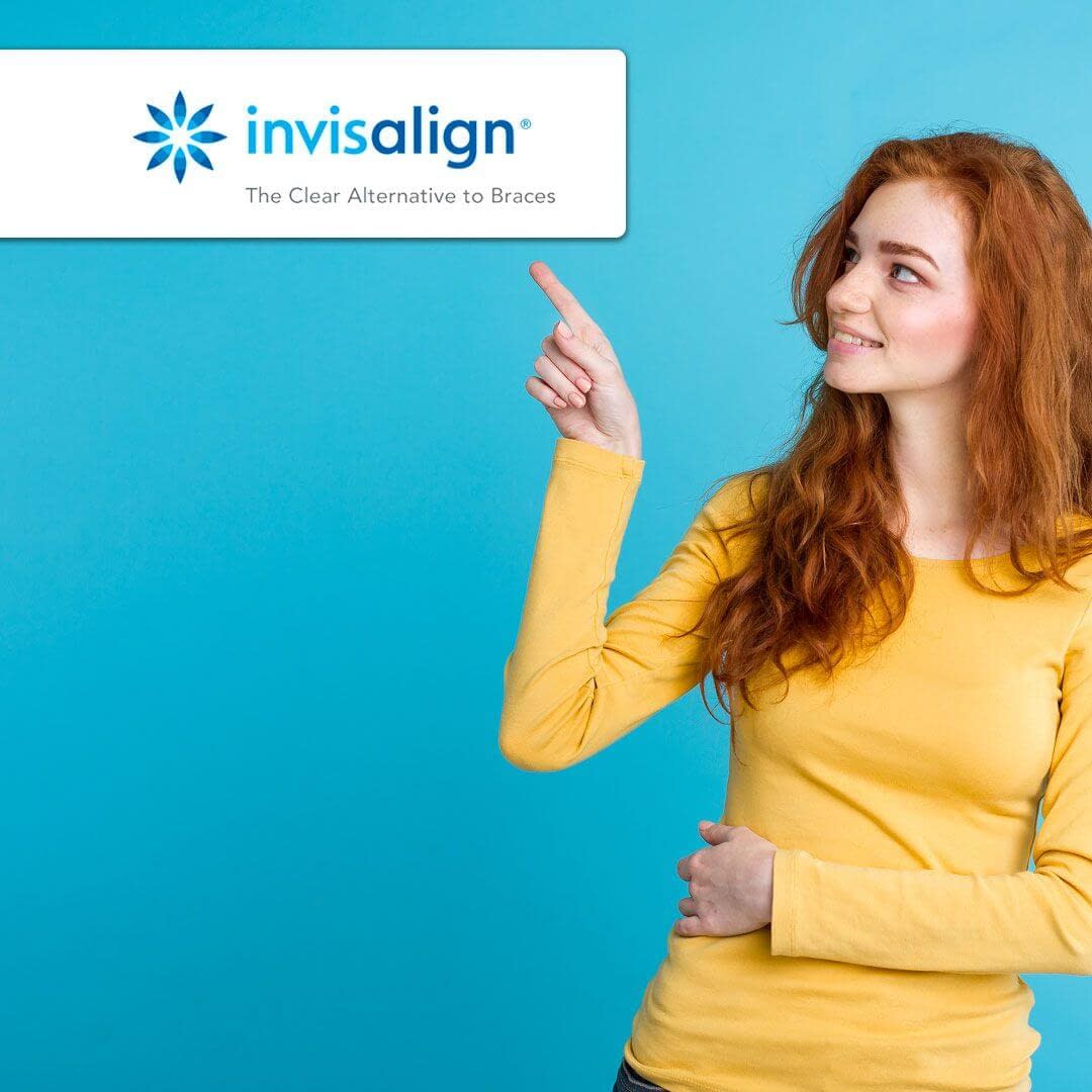 What to Know Before Starting Invisalign