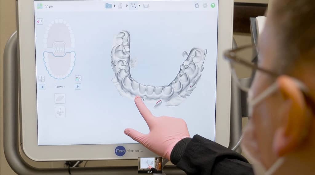 digital orthodontic scans