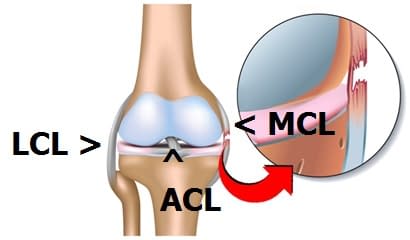 MCL-Injury-Recovery-jpeg