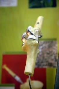 Knee Replacement