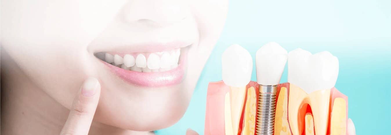 woman smiling next to model of dental implants