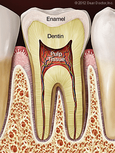 Root canal tooth diagram showing enamel, dentin, and pulp tissue.