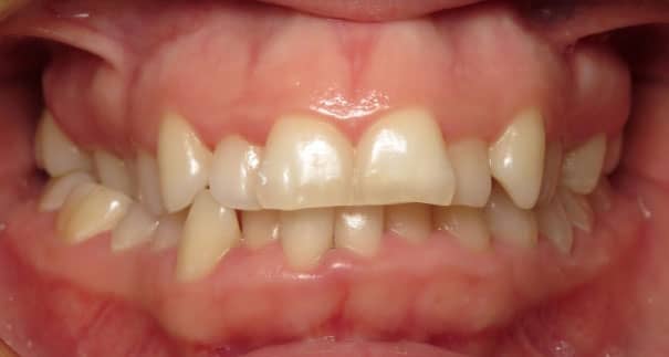 Vermette Orthodontics