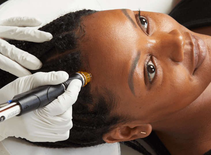 Hydrafacial Keravive