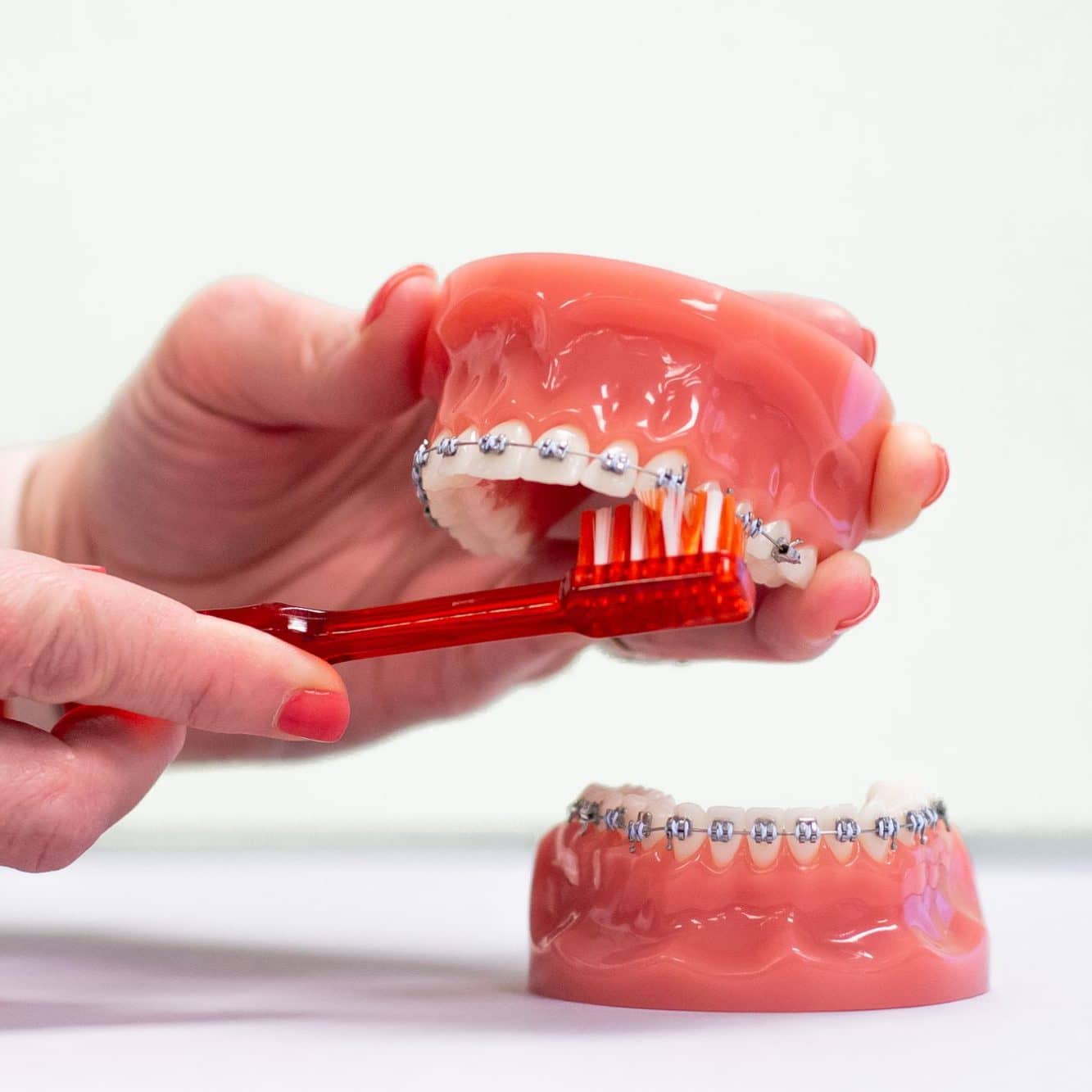 metal braces being brushed